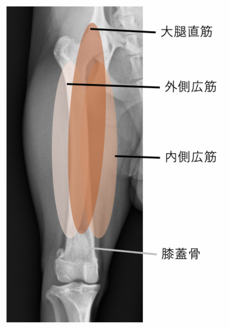 レントゲン写真を用いた内側支帯解放術の解説図